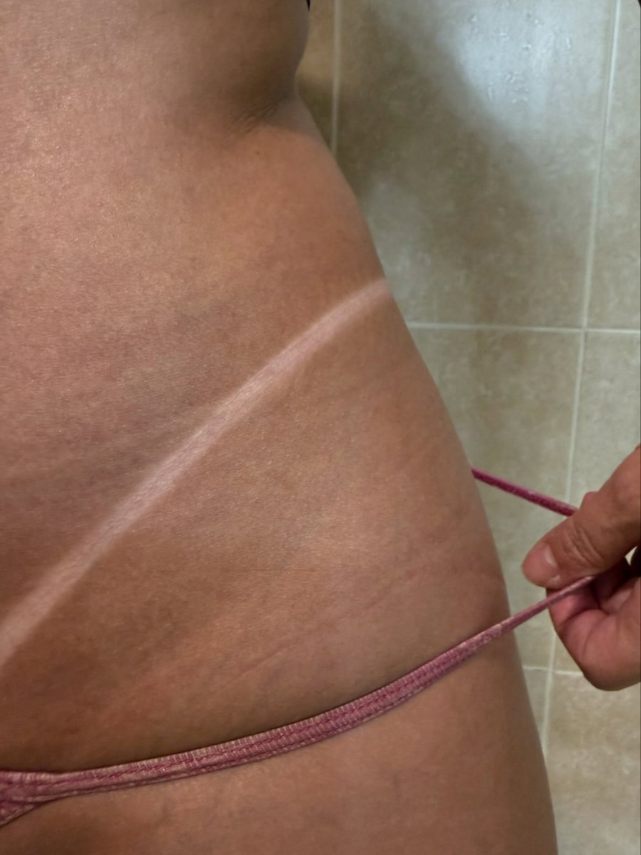 Spray tan line result