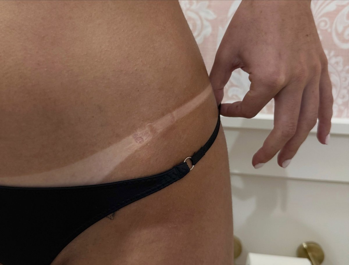 Spray tan line result