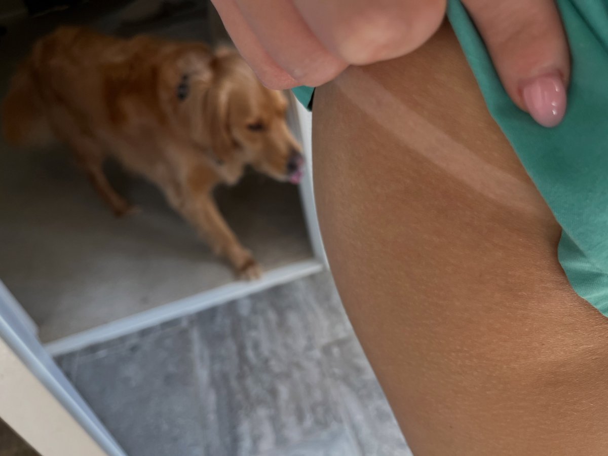 Spray tan line result