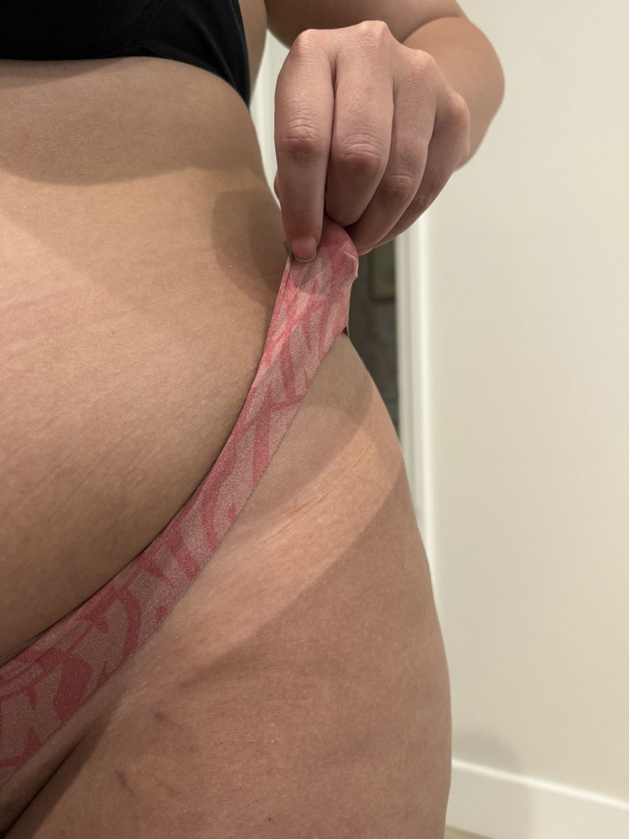 Spray tan line result